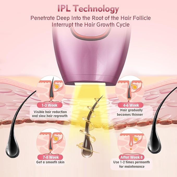 IPL Laser Hair Removal Device – Painless At-Home Hair Removal for Face & Body (White) - Image 4